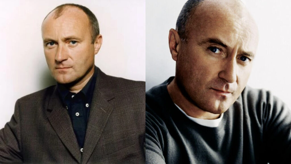 Phil Collins Krank